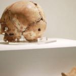 Dünyadaki ilk beyin ameliyatının yapıldığı Aşıklı Höyük tarihe ışık tutuyor