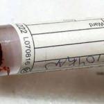 &Ccedil;ubuk'ta kırım kongodan &ouml;l&uuml;m