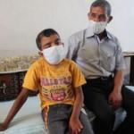 10 ameliyat geçiren ve bir gözünü kaybeden Veysel sağlığına kavuşmayı bekliyor