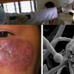 Hindistan'da yeni salgın endişesi! H&uuml;k&uuml;mete uyarı: &Ouml;l&uuml;m oranı y&uuml;zde 94'e &ccedil;ıkabilir