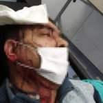 İmamın tabureyle vurduğu m&uuml;ezzinin kafasına 10 dikiş atıldı