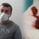 Hastalığı bir türlü bulunamıyordu, böbrek üstü tümörü teşhisi kondu