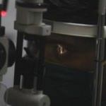 Hindistan'da siyah mantar tehdidi: 27 binin &uuml;zerinde vaka var