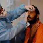 Arjantin'de Kovid-19 bağlantılı ilk 'Kara Mantar' vakası a&ccedil;ıklandı