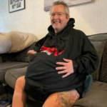 Hastalığı yüzünden böbrekleri 40 kiloya ulaştı, ciğerlerini ve kalbini eziyor