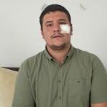Saldırıya uğrayan İHA muhabiri Akşener’i yalanladı