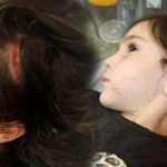 6 yaşındaki Narin, sevdiği köpeğin saldırısında yaralandı