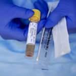 Son dakika: 7 Temmuz koronavirüs tablosu! Vaka, Hasta, ölü sayısı ve son durum açıklandı