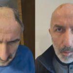 5 ay karnında taşıdığı kafatası kemikleriyle ikinci kez hayata bağlandı