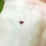 Kene vakalarında endişe verici artış!