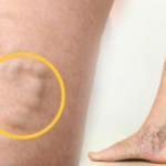 Pandemide hareketsizlik arttı! Varis görülme yaşı küçüldü