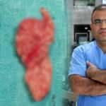 Nefes alamıyorum diyerek gitti! Burnundan 10 santimlik tümör alındı