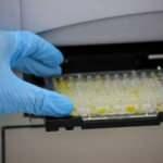 Yerli ve milli antikor testi: Quanticor