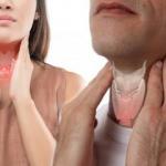 Tedavi edilmediği takdirde ölümcül sonuçlar doğuruyor: Hipotiroide dikkat