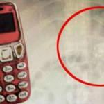 Kosova'da midesinden Nokia 3310 çıktı!