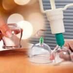 2021 hacamat takvimi: Aralık ayında hangi günler hacamat yaptırılır? Hacamatın faydaları...