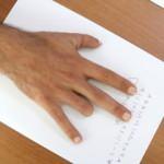 Konya'da literatüre giren parmak nakli! Yüzük parmağı baş parmağı oldu