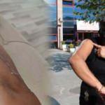 Güzellik merkezinde yaptırdığı lazer işlemi sonrası kolu ve bacağı yandı