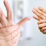 Dünyada 350 milyon kişide görülen artrit hastalığına dikkat!