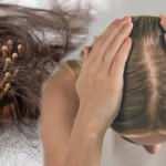 Pandemide artışa geçti! Saç dökülmesi neden olur?