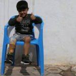 Suriyeli Muhammed hayata tutunacağı protez bacağa kavuştu