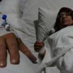 Van'da 62 yaşındaki hastaya baş parmağından anjiyo yapıldı