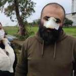 Tasmasız dolaştırılan pitbull dehşet saçtı! Burnunu kopardı