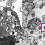 Omicron varyantının elektron mikroskobu görüntüsü yayınlandı