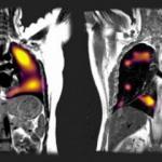 Çinli bilim insanları ortaya çıkardı! Akciğer dokusunun yaşlanmasını hızlandırıyor