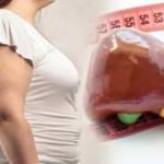 Karaciğer yağlanması nedir? Ne şekilde ortaya çıkar?