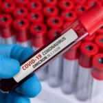 Uzmanından “Omicron” varyantı uyarısı! İşte dikkat edilmesi gerekenler