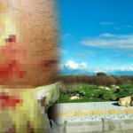 Antalya'da 60 yaşındaki adam yürüyüş yaparken köpek saldırısına uğradı