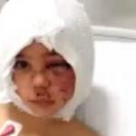 Pitbull saldırısına uğrayan küçük Asiye olayında yeni gelişme! 