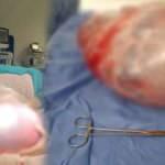 Karın şişliği şikayetiyle hastaneye başvurdu, karnından 9 kilogramlık tümör çıkarıldı