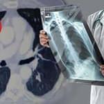 Koronavirüsten yıpranan akciğerleri ve bağışıklığı güçlendirme yolları