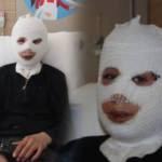 Erzurum&rsquo;da feci olay! Isınmak isterken &ccedil;aydanlık &uuml;zerine devrildi   