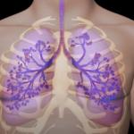 Akciğeri temizleyen keçiboynuzu kürü nasıl hazırlanır? 1 haftada akciğeri toksinlerden arındıran kür tarifi...