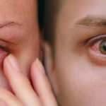 Halk arasında kırmızı göz hastalığı olarak biliniyor: Konjonktivit salgını