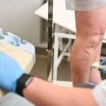 Obezite ve uzun yolculuklar neden oluyor: Pıhtı atması