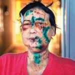 Rusya'nın saldırısı sonucu bu hale geldiler