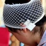 Sokak k&ouml;peklerinin saldırısına uğrayan &ccedil;ocuk &ouml;l&uuml;mden d&ouml;nd&uuml;