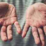 D&uuml;nya Sağlık &Ouml;rg&uuml;t&uuml;'nden umutlandıran maymun &ccedil;i&ccedil;eği &ouml;ng&ouml;r&uuml;s&uuml;