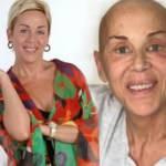 Billur Kalkavan kansere yakalandı! Billur Kalkavan'ın son hali...