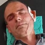 Hasta yakını, kendisini uyaran g&uuml;venlik g&ouml;revlisini darp etti