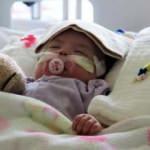 300 binde bir g&ouml;r&uuml;len rahatsızlığa yakalanan Aisha bebek, yaşam m&uuml;cadelesini kazandı