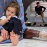 Yeniden yeşeren umut... İHH'dan savaş mağdurlarına protez desteği