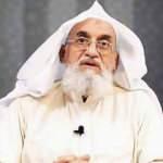 G&ouml;z doktorluğundan &ouml;rg&uuml;t liderliğine