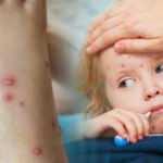 Domates gribi nedir, belirtileri nelerdir? Domates gribi tedavisi...