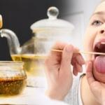 Bademcik iltihabına ne iyi gelir? Antibiyotikle geçmeyen bademcik iltihabı nasıl geçer?