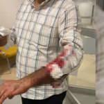 Parkta köpek dehşeti! Kaçtı ama kurtulamadı